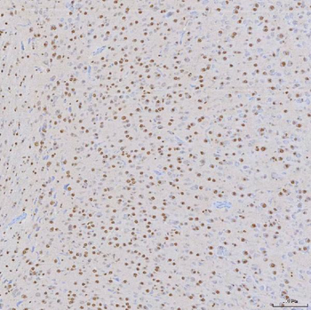 SNRNP200 Rabbit Polyclonal Antibody