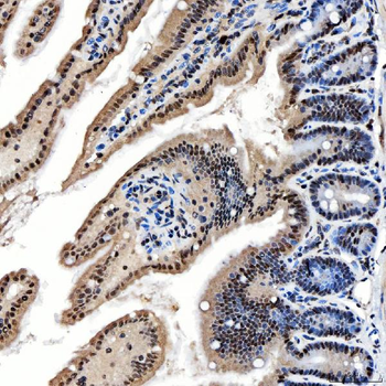 SNRNP200 Rabbit Polyclonal Antibody