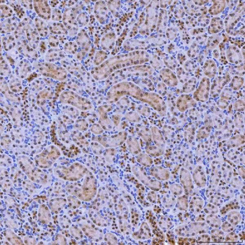 SNRNP200 Rabbit Polyclonal Antibody