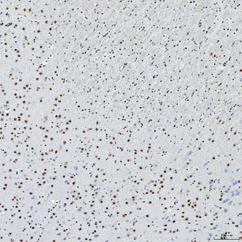 SNRNP200 Rabbit Polyclonal Antibody