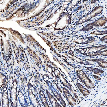 SNRNP200 Rabbit Polyclonal Antibody