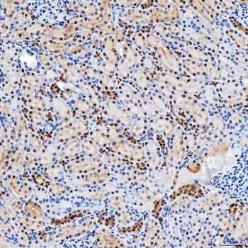 SNRNP200 Rabbit Polyclonal Antibody