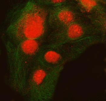 SNRNP200 Rabbit Polyclonal Antibody