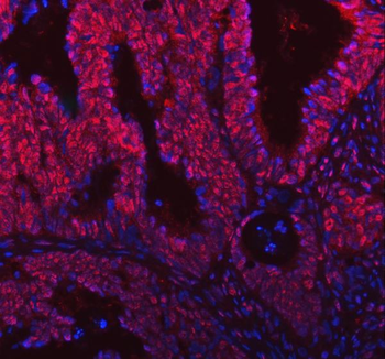 SNRNP200 Rabbit Polyclonal Antibody