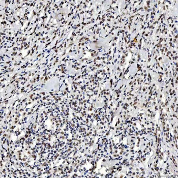 SNRNP200 Rabbit Polyclonal Antibody