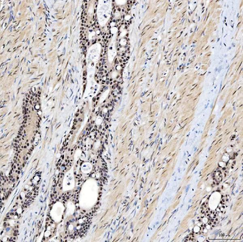 SNRNP200 Rabbit Polyclonal Antibody