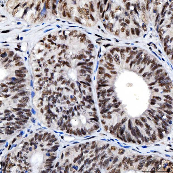 SNRNP200 Rabbit Polyclonal Antibody