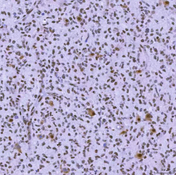 SNRNP200 Rabbit Polyclonal Antibody