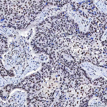 SNRNP200 Rabbit Polyclonal Antibody