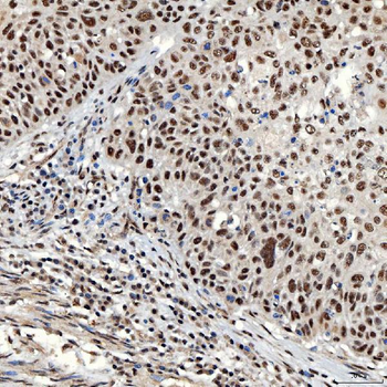 SNRNP40 Rabbit Polyclonal Antibody