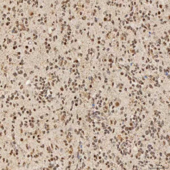 SNRNP40 Rabbit Polyclonal Antibody