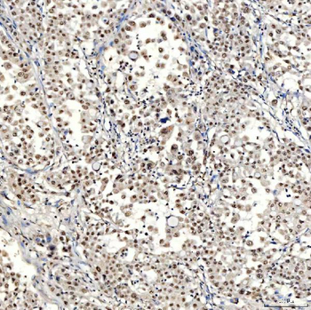 SNRNP40 Rabbit Polyclonal Antibody