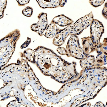 SNRNP40 Rabbit Polyclonal Antibody