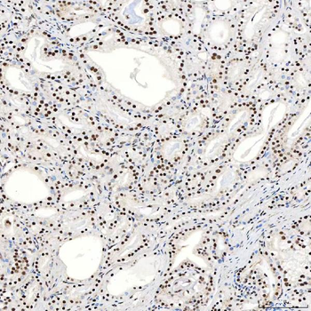 SNRNP40 Rabbit Polyclonal Antibody