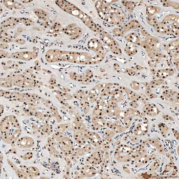 SNRNP40 Rabbit Polyclonal Antibody