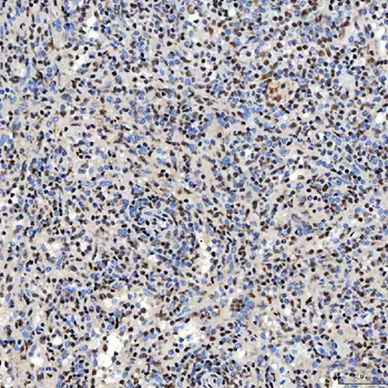SNRNP40 Rabbit Polyclonal Antibody