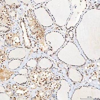 SNRNP40 Rabbit Polyclonal Antibody