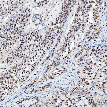 SNRNP40 Rabbit Polyclonal Antibody