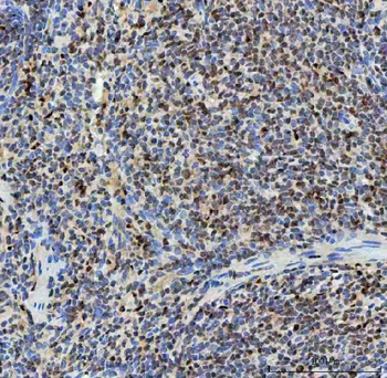SNRNP40 Rabbit Polyclonal Antibody