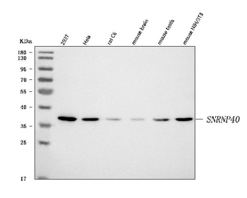 SNRNP40 Rabbit Polyclonal Antibody