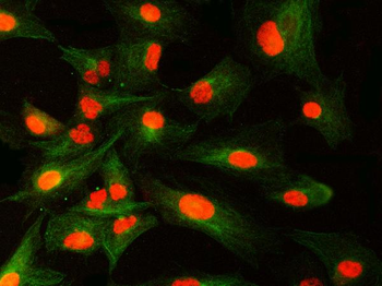 SNRNP40 Rabbit Polyclonal Antibody