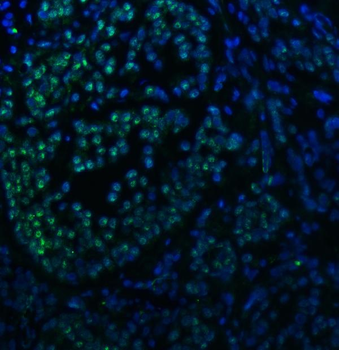 SNRNP40 Rabbit Polyclonal Antibody