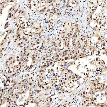 SNRNP40 Rabbit Polyclonal Antibody
