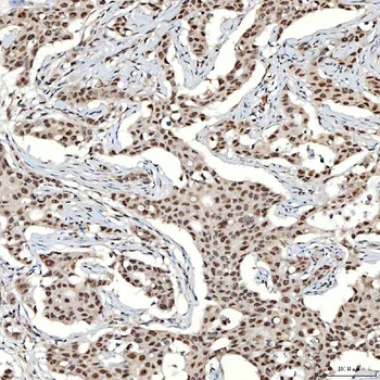 SNRNP40 Rabbit Polyclonal Antibody