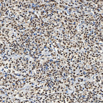 SNRNP40 Rabbit Polyclonal Antibody