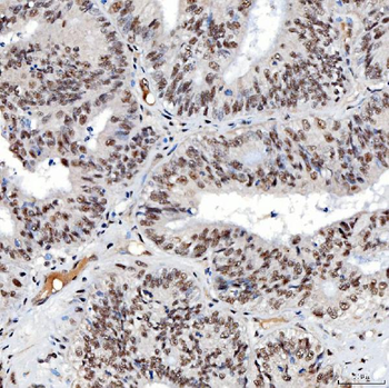 SNRNP40 Rabbit Polyclonal Antibody