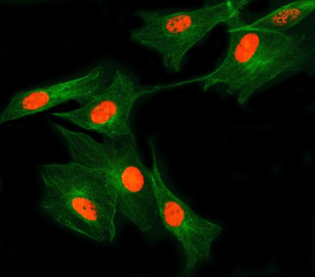 SNRNP27 Rabbit Polyclonal Antibody
