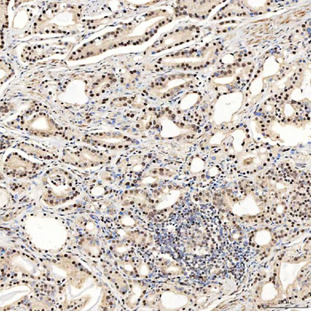 SNRNP27 Rabbit Polyclonal Antibody