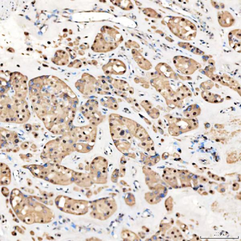 SNRNP27 Rabbit Polyclonal Antibody