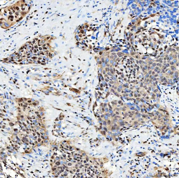 SNRNP27 Rabbit Polyclonal Antibody