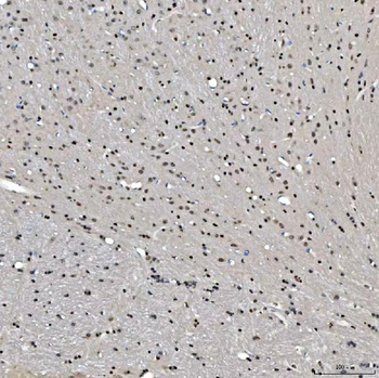 SNRNP27 Rabbit Polyclonal Antibody