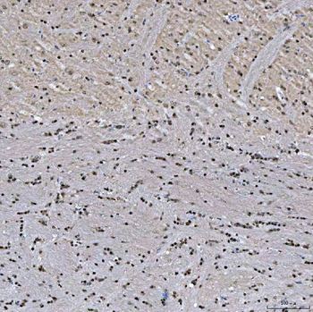 SNRNP27 Rabbit Polyclonal Antibody