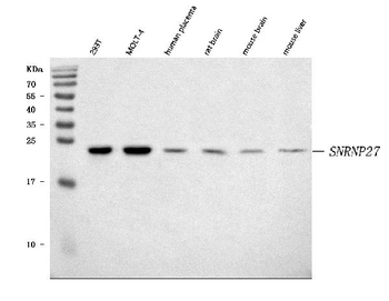 SNRNP27 Rabbit Polyclonal Antibody