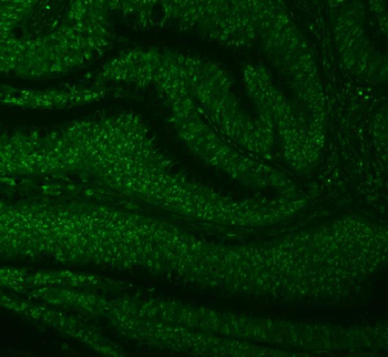 SNRNP27 Rabbit Polyclonal Antibody