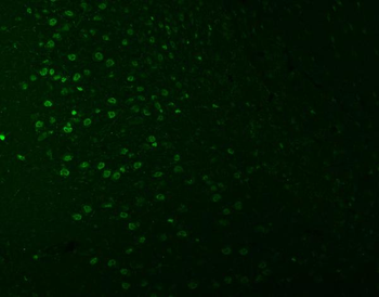 SNRNP27 Rabbit Polyclonal Antibody