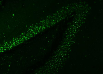 SNRNP27 Rabbit Polyclonal Antibody