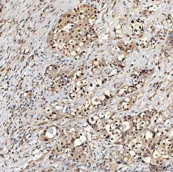 SNRNP27 Rabbit Polyclonal Antibody