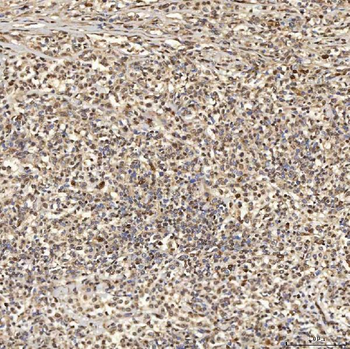 SNRNP27 Rabbit Polyclonal Antibody