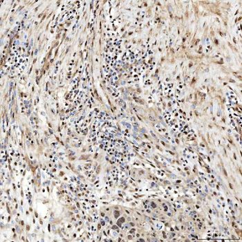 SNRNP27 Rabbit Polyclonal Antibody