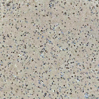 SNRNP27 Rabbit Polyclonal Antibody