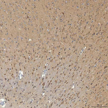 SNPH Rabbit Polyclonal Antibody