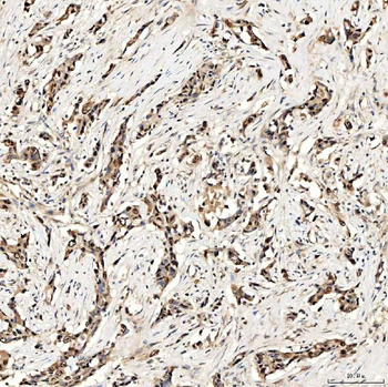SMOX Rabbit Polyclonal Antibody