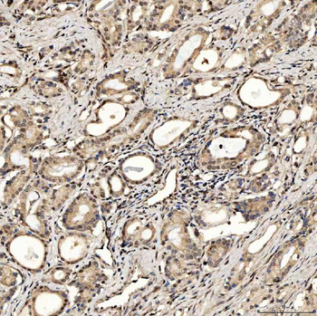 SMOX Rabbit Polyclonal Antibody