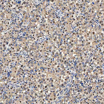 SMOX Rabbit Polyclonal Antibody