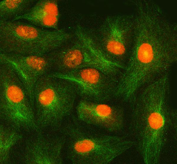 SMOX Rabbit Polyclonal Antibody