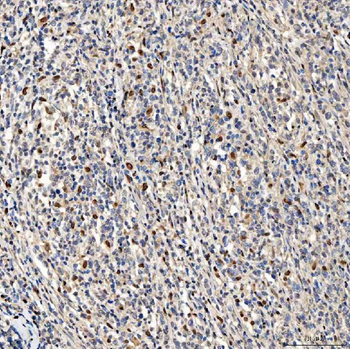 SMOX Rabbit Polyclonal Antibody